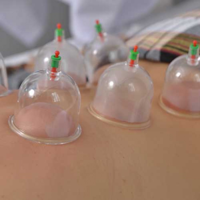 Hacamat Kupa Seti 6 Adet Hacamat Kupa Seti 6 Adet