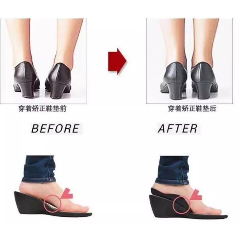 Esnek Düz Taban Düzeltici Topuk Yastığı